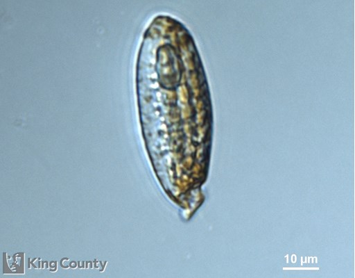 Photo of Torodinium cf. robustum